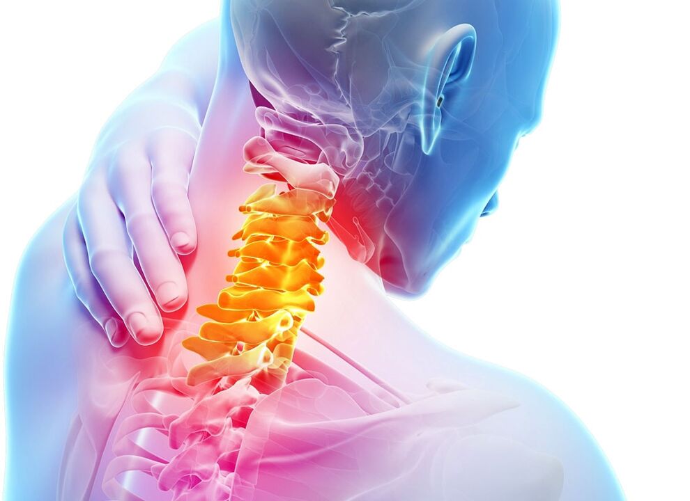 objawy osteochondrozy szyjnej